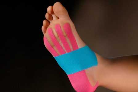 Кинезиотейпирование стопы