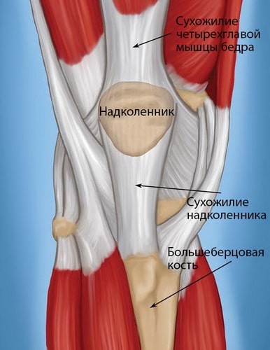 тендинопатия колена