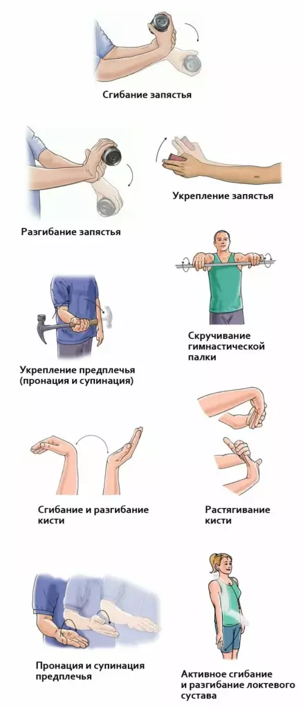 Упражнения при латеральном эпикондилите (локоть теннисиста).